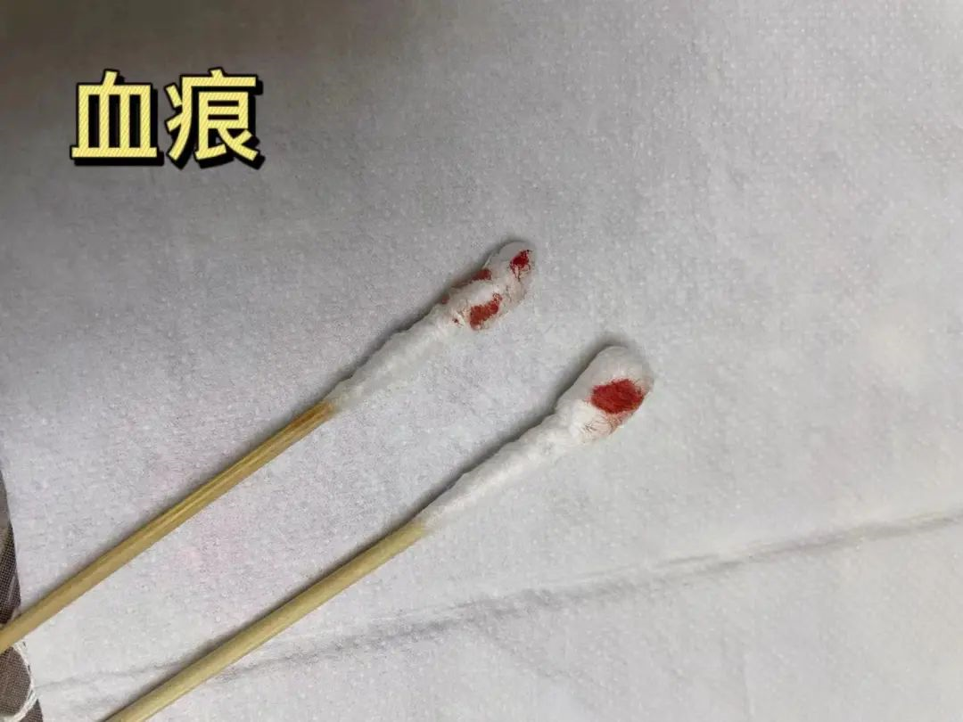 親子鑒定樣本采集棉棒上的血痕可以嗎？