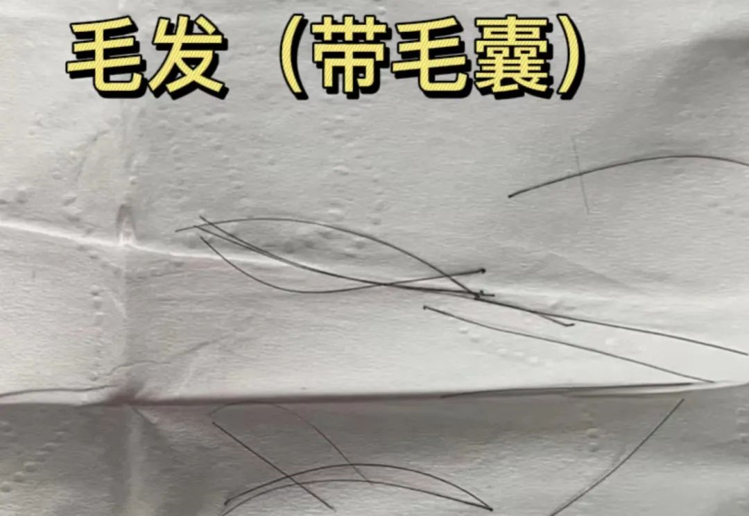 親子鑒定樣本采集棉棒上的血痕可以嗎？
