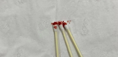 個(gè)人親子鑒定可以郵寄血樣檢材嗎？樣本有哪些注意事項(xiàng)？