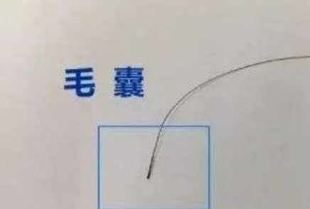 什么是親子判定？小梅與陳姑娘的故事