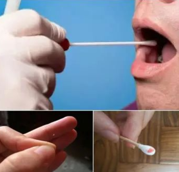 親子鑒定人可以自己在家取口腔棉簽樣本嗎？