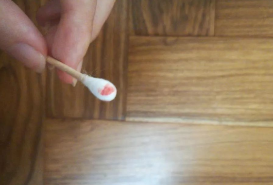 煙頭、血痕、毛發(fā)，做親子鑒定用哪些樣本最為準確？