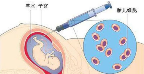 孕期做胎兒親子鑒定合適嗎？孕期有哪些胎兒親子鑒定方法？