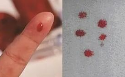 匿名親子鑒定需要準(zhǔn)備什么？親子鑒定工作人員采樣本流程有哪些？