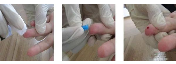 在家怎樣做親子鑒定最簡單？毛發(fā)樣本采集好后放入標(biāo)記好的信封內(nèi)