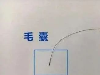 毛發(fā)可以做親子鑒定檢材嗎，怎么采集樣本才可以？